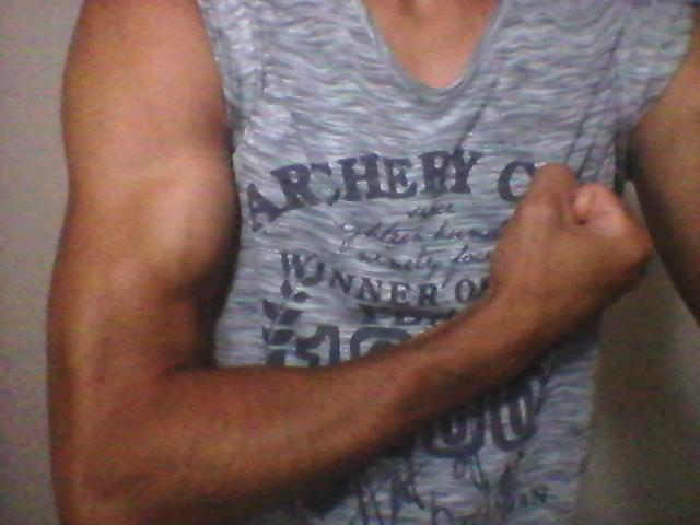My arm is pretty ?