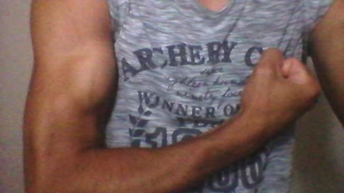 My arm is pretty ?