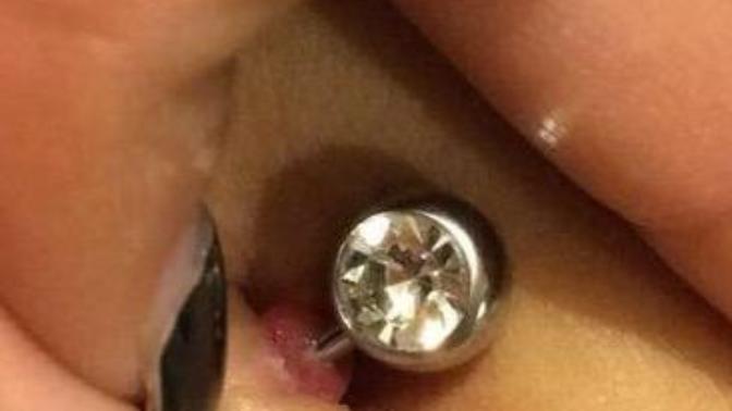 How to heal infected belly button piercing?