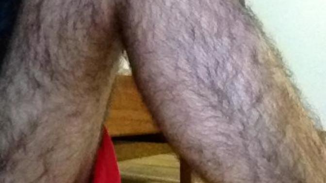Should I remove my leg hairs by laser hair removal?