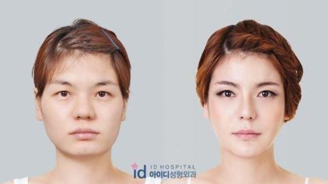 Would you date someone who has had plastic surgery?