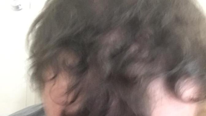 What a good shampoo to treat thinning hair?