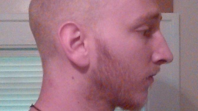Does anyone else have an odd head shape? I am bald and I have a weird head so idk?