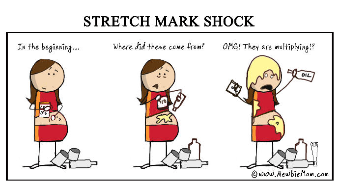 How to prevent stretch-marks while I am losing weight?