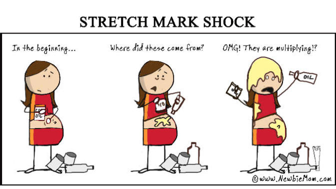 How to prevent stretch-marks while I am losing weight?