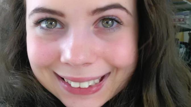 (pictures) BuckTeeth... Cute? Sexy? Ugly?