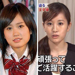 How common is it for a man to pay for his girlfriend/wife/mistress' cosmetic surgery?