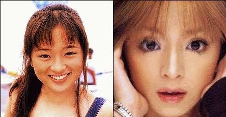 How common is it for a man to pay for his girlfriend/wife/mistress' cosmetic surgery?