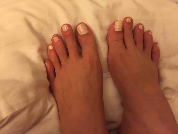 Damn my Celtic Feet?