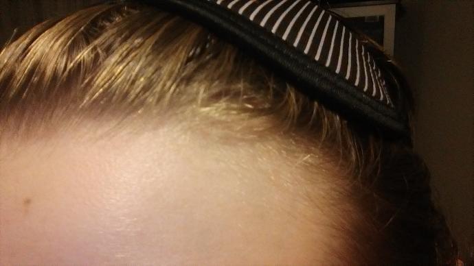Guys,Do i have a hair loss...?