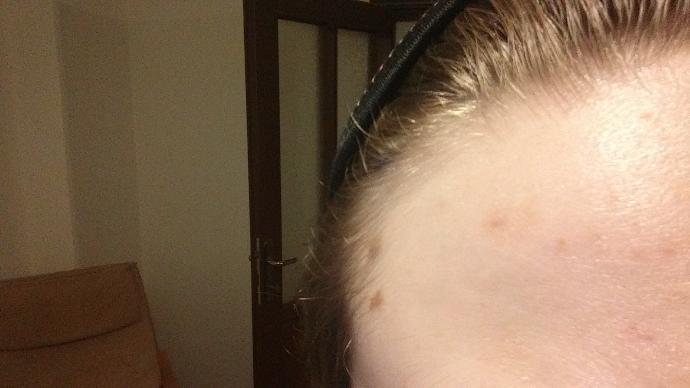 Guys, Do I have a hair loss?