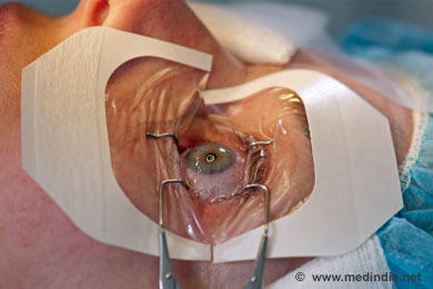Is lasik eye surgery worth it?