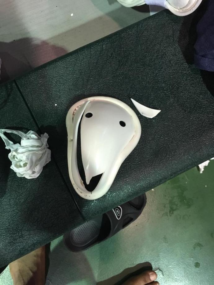 Boyfriend hurt his testilcles?