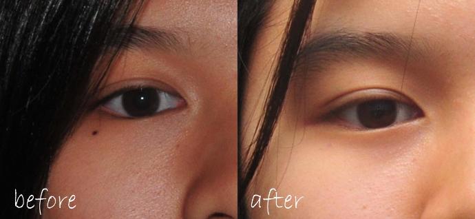 Are small moles under the eyes attractive?