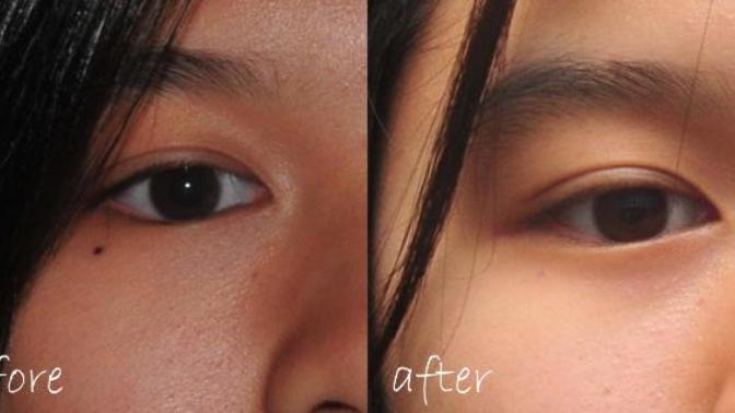 Are small moles under the eyes attractive?