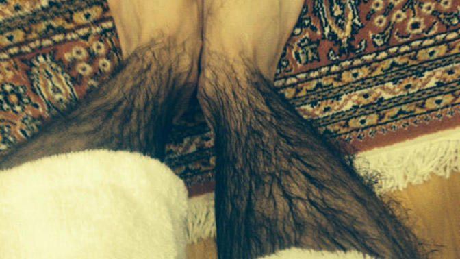 Hi, my legs are hairy?