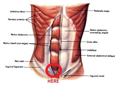 For anyone who is very physically active: telling between a hernia and an abdominal wall tear?