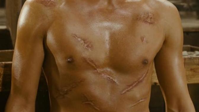 Hey Ladies, I'm self conscious about body scars, how to deal with them especially around girls?