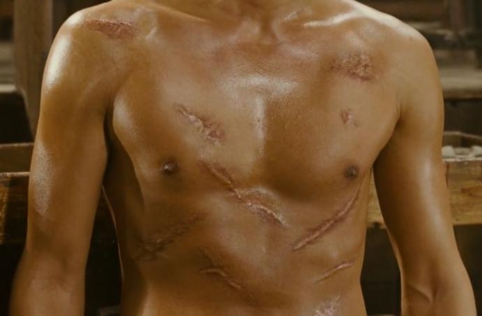 Girls, Question for girls, I hate my body scars, what would you think?