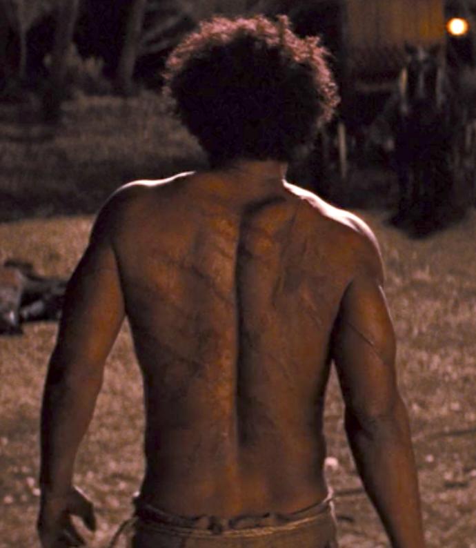 Girls, Question for girls, I hate my body scars, what would you think?
