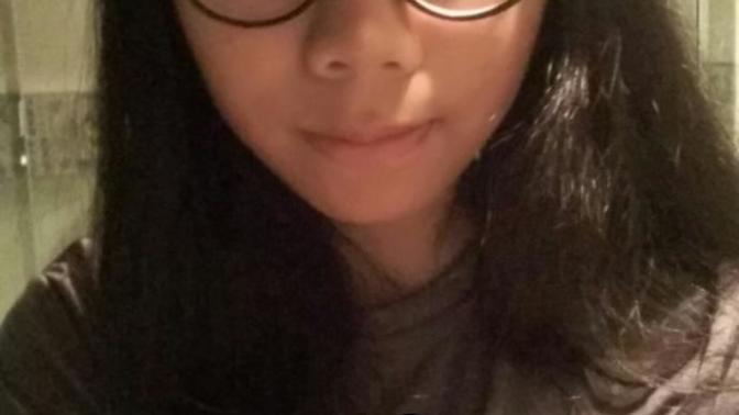 Do I need a nose job or plastic surgery?