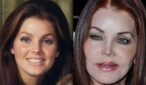 Name ONE celebrity who has destroyed their good looks with plastic surgery?