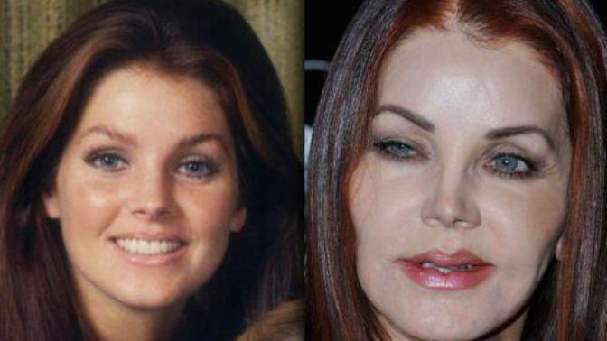 Name ONE celebrity who has destroyed their good looks with plastic surgery?