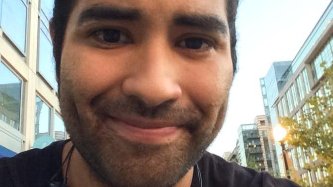 Are cheek dimples actually attractive?