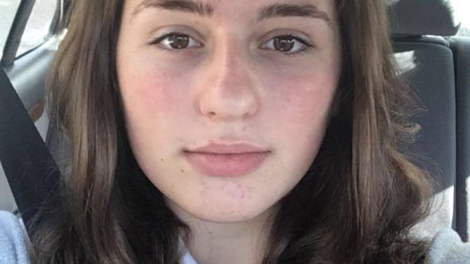 Do you dare to post a selfie without makeup/filter?