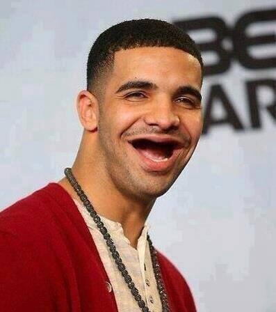 Do YOU have yellow teeth?