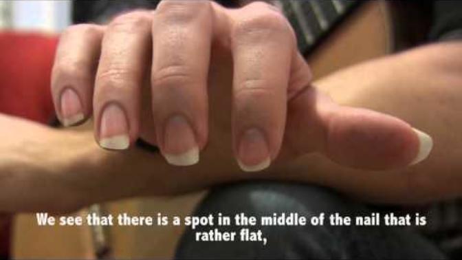 What is the grossest technique which actually works, in your opinion?