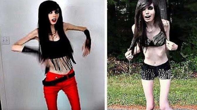 Should Eugenia Cooney Be Banned From YouTube Because Of Her Eating Disorder?