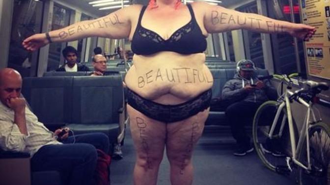 What's up with girls thinking they are special little snowflakes by having stretch marks on their booty?