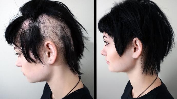 Would you date someone who suffers from alopecia (hair loss)?