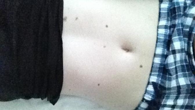 Do these moles look bad? turn off?