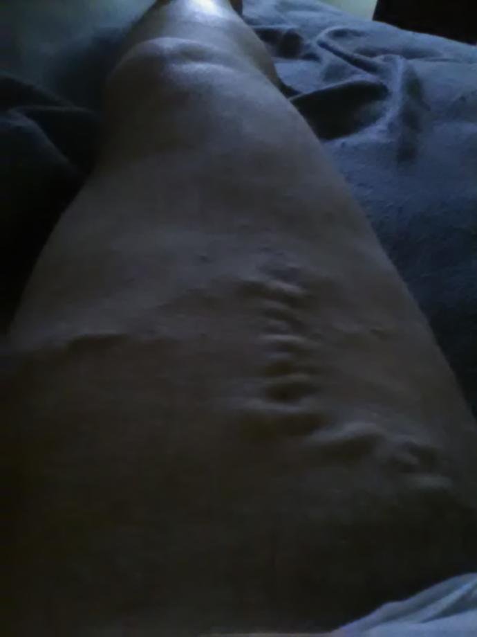 Does this gross you out?