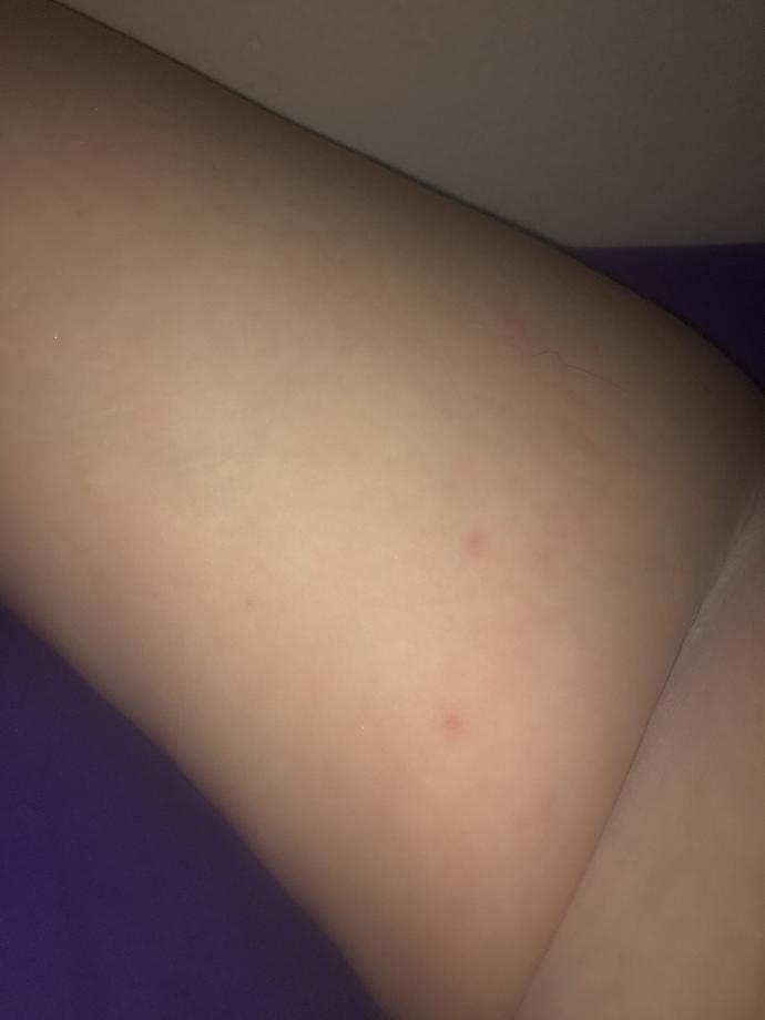 What is this on my arm?