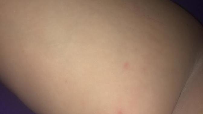 What is this on my arm?