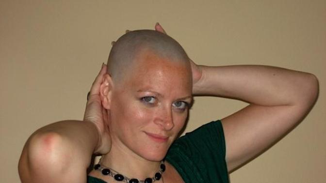 Im thinking of shaving my head bald what do you think should I do and if you have done it how was it?
