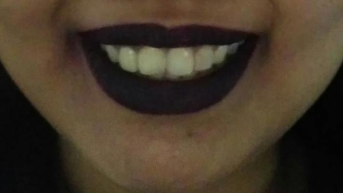 Yellowish teeth. Picture. Should I stay away from bold lipsticks?