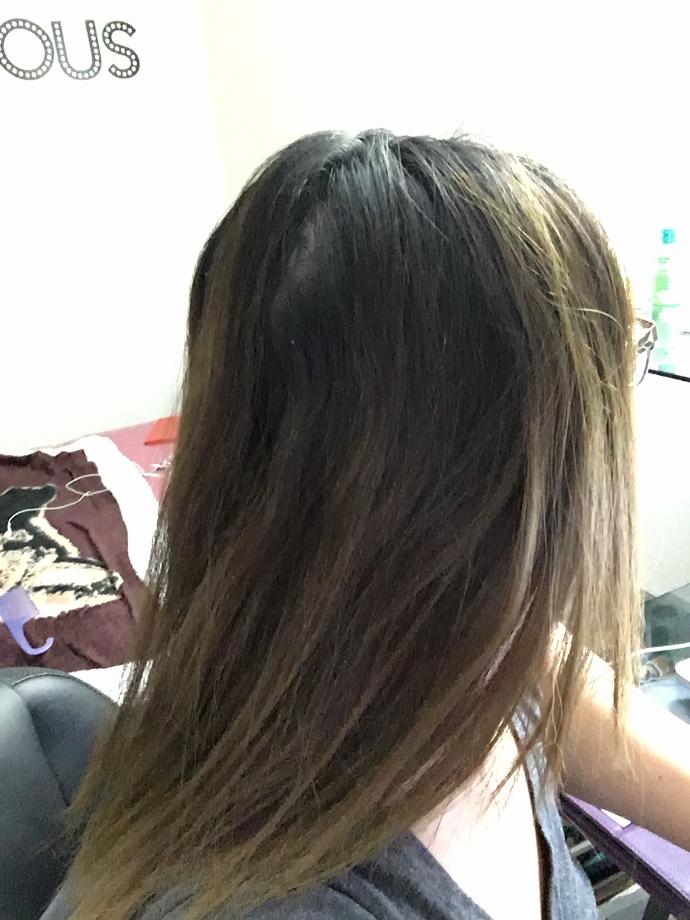 See picture: is my friend going bald at such a young age? <br />?