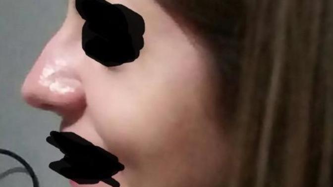 What do you think about this nose?