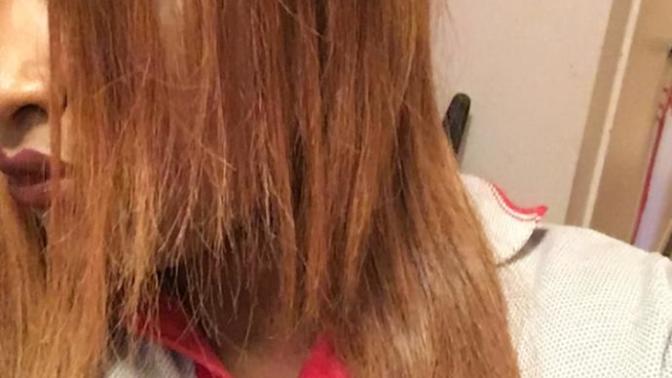 How to get rid of hair that's been dyed orange by accident?