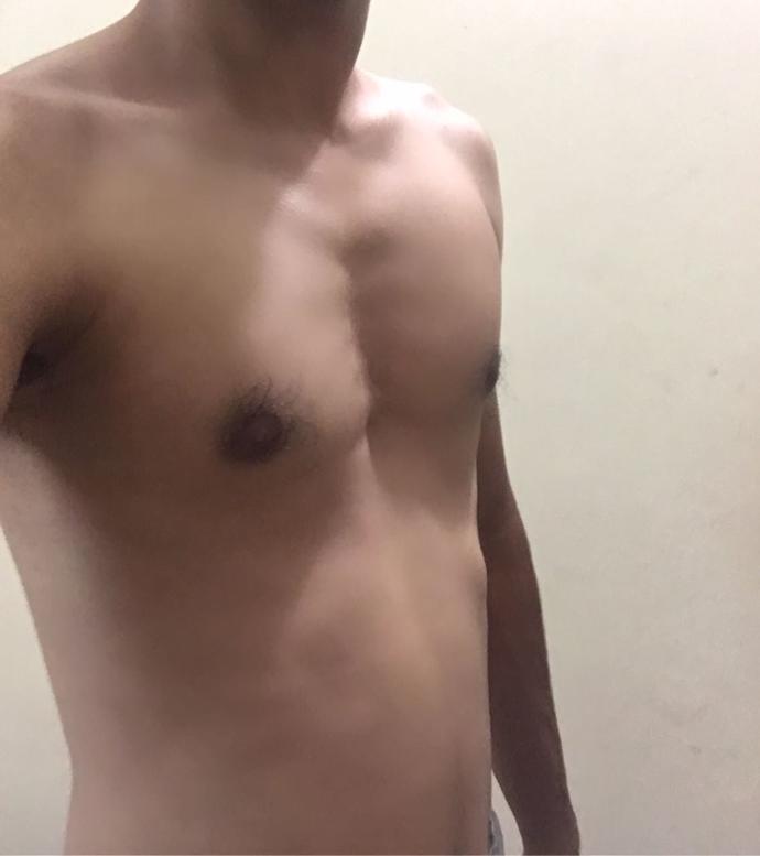 Is my chest attractive? (pic included)?