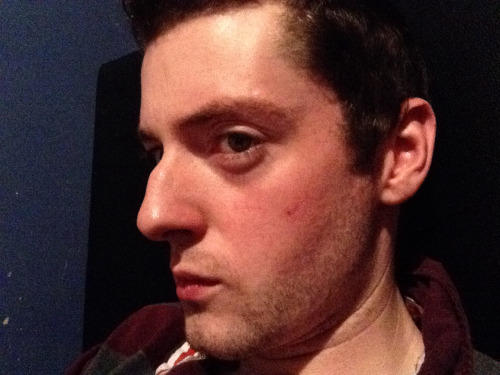 Girls, Is a big nose a deal breaker???