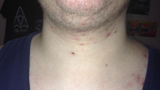 Girls, How ugly is my chin fat/jawline?