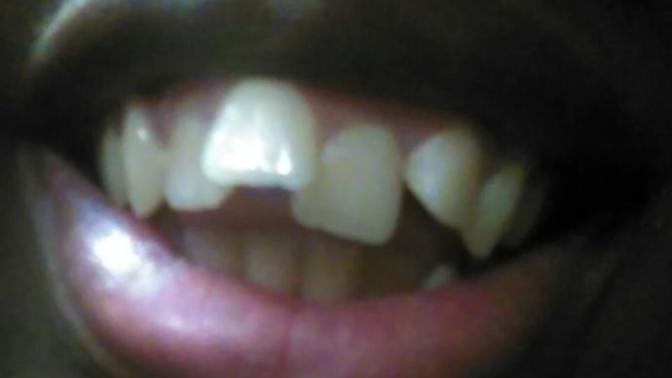 What do guys think of crooked teeth?