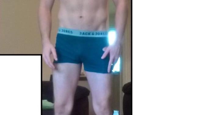 Girls, Really Skinny Lower Legs Would It Put You Off A Guy With Pics?