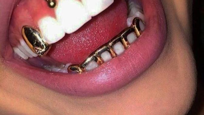 What do boys think about girls having piercing ( smiley piercing)?