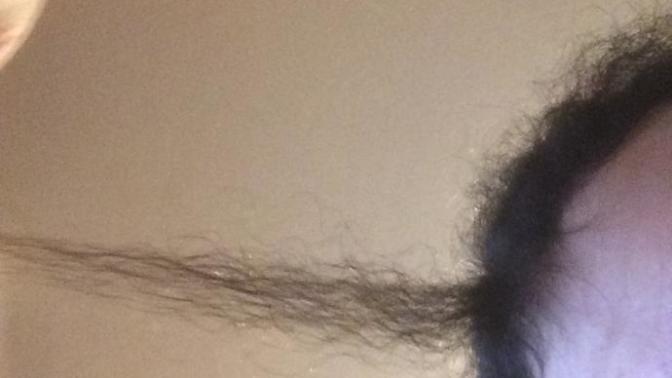 Why do I have little inch hairs/very short hairs on top of my head?